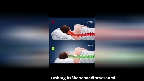 بالش طبی و اصلاح مشکلات گردن ، شهاب الدین معصومی