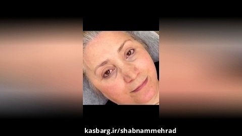 بهترین مرکز میکروبلیدینگ ابرو در اصفهان،فیبروز دخترونه ،فیبروز مویی اصفهان