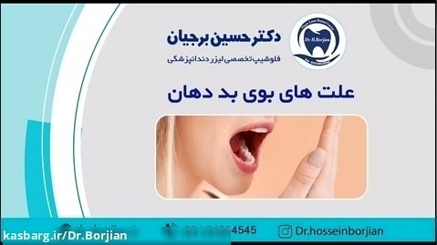 علت بوی بد دهان | بهترین دندانپزشک اصفهان
