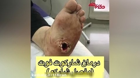 کلینیک زخم در غرب تهران