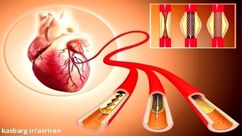 11 تا از مضرترین مواد غذایی که رگ های قلب را مسدود می کنند