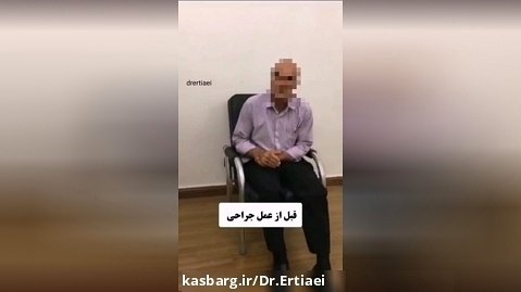 درمان بیمار مبتلا به پارکینسون توسط دکتر ابوالحسن ارتیاعی
